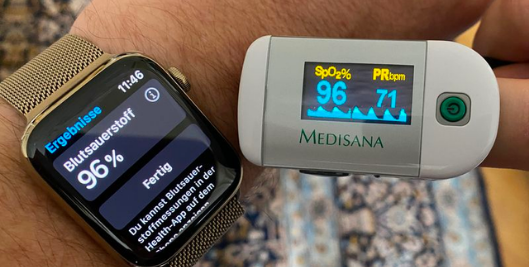 Apple Watch có đo được huyết áp không