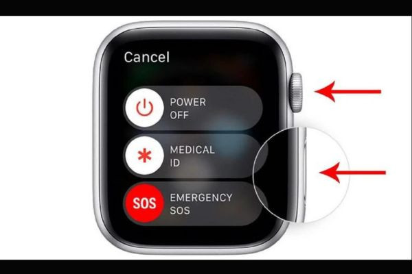 Apple Watch bị sọc màn hình