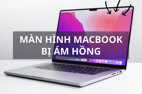 Màn hình MacBook bị ám hồng