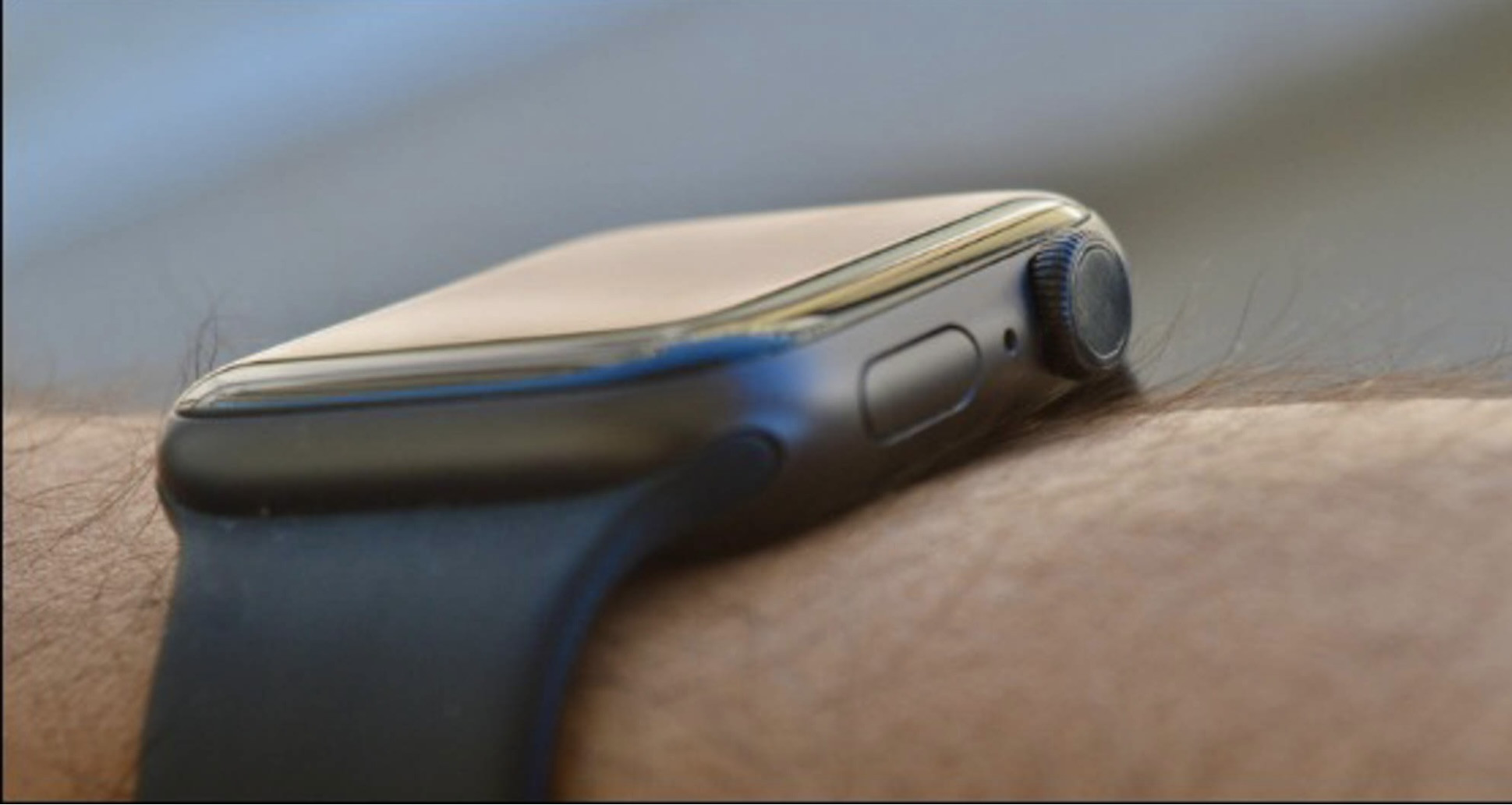 Nguyên nhân dẫn đến nút nguồn Apple Watch Series 7 bị hư
