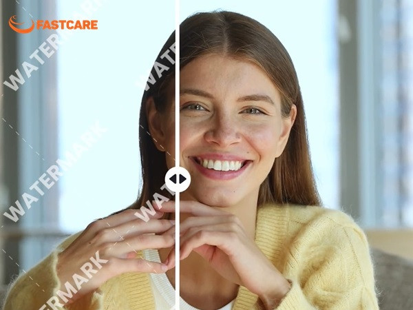Xóa watermark online